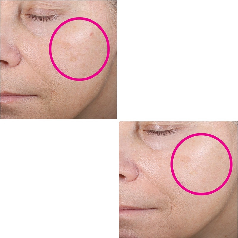 سرم ضد چروک دی اوردینری مدل Retinol 0.5% in Squalane حجم 30 میلی لیتر